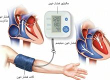 غربالگری بیش از ۱۲ میلیون نفر از نظر فشارخون و دیابت / آمار ابتلا به این دو بیماری در کشور