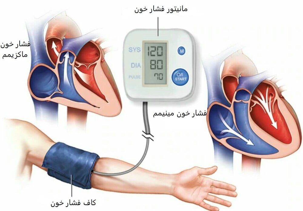 غربالگری بیش از ۱۲ میلیون نفر از نظر فشارخون و دیابت / آمار ابتلا به این دو بیماری در کشور