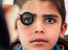 تنبلی چشم یکی از شایع‌ترین علل نابینایی در کودکان است